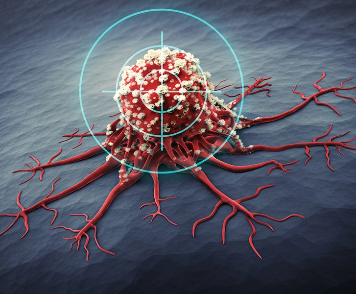 Le traitement à l'iode radioactif ou irathérapie - Cancer de la